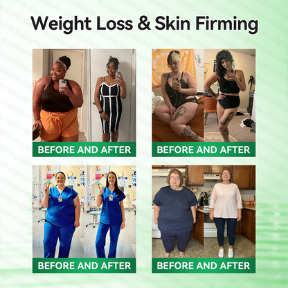 🇺🇸 𝐎𝐟𝐟𝐢𝐜𝐢𝐚𝐥 𝐔.𝐒. 𝐒𝐭𝐨𝐫𝐞 | 💚 𝑪𝒂𝒓𝒆𝑼𝒑𝒍𝒊𝒇𝒕® 𝟏𝟎-𝐢𝐧-𝟏 𝐍𝐚𝐧𝐨 𝐏𝐚𝐭𝐜𝐡 🌿 𝑴𝒐𝒓𝒊𝒏𝒈𝒂 · 𝑩𝒆𝒓𝒃𝒆𝒓𝒊𝒏𝒆 × 𝐍𝐀𝐃+ 𝐬𝐮𝐩𝐩𝐨𝐫𝐭𝐬 𝐦𝐞𝐭𝐚𝐛𝐨𝐥𝐢𝐬𝐦, 𝐚𝐩𝐩𝐞𝐭𝐢𝐭𝐞 𝐛𝐚𝐥𝐚𝐧𝐜𝐞, 𝐞𝐧𝐞𝐫𝐠𝐲, 𝐛𝐥𝐨𝐚𝐭𝐢𝐧𝐠 𝐫𝐞𝐥𝐢𝐞𝐟 & 𝐡𝐞𝐚𝐥𝐭𝐡𝐲 𝐛𝐥𝐨𝐨𝐝 𝐬𝐮𝐠𝐚𝐫 𝐛𝐚𝐥𝐚𝐧𝐜𝐞. 𝐎𝐧𝐜𝐞 𝐝𝐚𝐢𝐥𝐲. 𝐍𝐨 𝐬𝐡𝐨𝐭𝐬. 𝐍𝐨 𝐩𝐢𝐥𝐥𝐬.