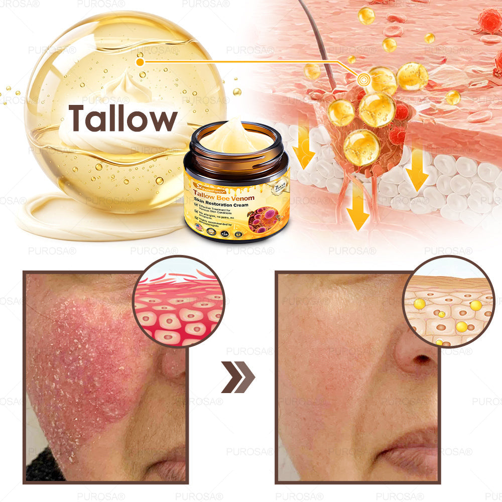 🏥A professional team of dermatologists has experimentally developed PolarFresh® Tallow Bee Venom Skin Restoration Cream – Repairs and protects, preventing recurrence