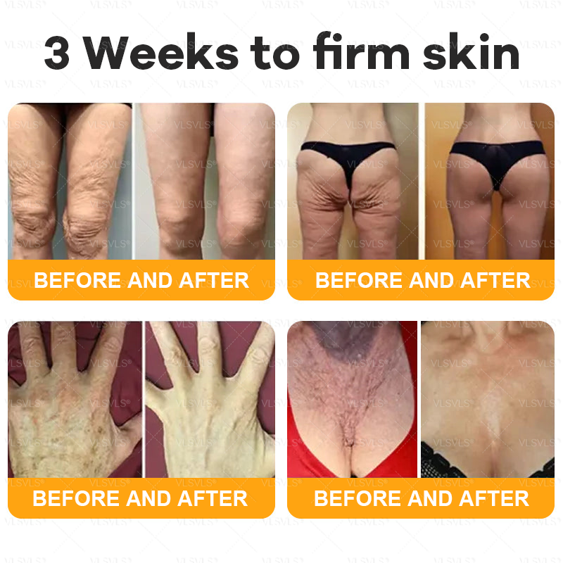 🏥A professional team of dermatologists has experimentally developed PolarFresh® Tallow Bee Venom Skin Restoration Cream – Repairs and protects, preventing recurrence