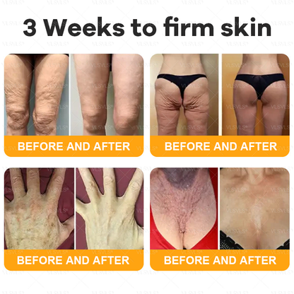 🏥A professional team of dermatologists has experimentally developed PolarFresh® Tallow Bee Venom Skin Restoration Cream – Repairs and protects, preventing recurrence