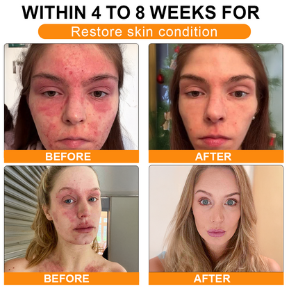 🏥A professional team of dermatologists has experimentally developed PolarFresh® Tallow Bee Venom Skin Restoration Cream – Repairs and protects, preventing recurrence