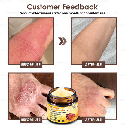 🏥A professional team of dermatologists has experimentally developed PolarFresh® Tallow Bee Venom Skin Restoration Cream – Repairs and protects, preventing recurrence