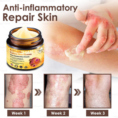 🏥A professional team of dermatologists has experimentally developed PolarFresh® Tallow Bee Venom Skin Restoration Cream – Repairs and protects, preventing recurrence