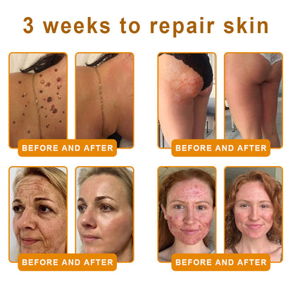 🏥A professional team of dermatologists has experimentally developed PolarFresh® Tallow Bee Venom Skin Restoration Cream – Repairs and protects, preventing recurrence