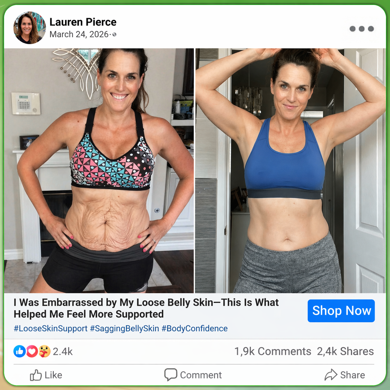 🇺🇸 𝐎𝐟𝐟𝐢𝐜𝐢𝐚𝐥 𝐔.𝐒. 𝐒𝐭𝐨𝐫𝐞 | 💚 𝑪𝒂𝒓𝒆𝑼𝒑𝒍𝒊𝒇𝒕® 𝟏𝟎-𝐢𝐧-𝟏 𝐍𝐚𝐧𝐨 𝐏𝐚𝐭𝐜𝐡 🌿 𝑴𝒐𝒓𝒊𝒏𝒈𝒂 · 𝑩𝒆𝒓𝒃𝒆𝒓𝒊𝒏𝒆 × 𝐍𝐀𝐃+ 𝐬𝐮𝐩𝐩𝐨𝐫𝐭𝐬 𝐦𝐞𝐭𝐚𝐛𝐨𝐥𝐢𝐬𝐦, 𝐚𝐩𝐩𝐞𝐭𝐢𝐭𝐞 𝐛𝐚𝐥𝐚𝐧𝐜𝐞, 𝐞𝐧𝐞𝐫𝐠𝐲, 𝐛𝐥𝐨𝐚𝐭𝐢𝐧𝐠 𝐫𝐞𝐥𝐢𝐞𝐟 & 𝐡𝐞𝐚𝐥𝐭𝐡𝐲 𝐛𝐥𝐨𝐨𝐝 𝐬𝐮𝐠𝐚𝐫 𝐛𝐚𝐥𝐚𝐧𝐜𝐞. 𝐎𝐧𝐜𝐞 𝐝𝐚𝐢𝐥𝐲. 𝐍𝐨 𝐬𝐡𝐨𝐭𝐬. 𝐍𝐨 𝐩𝐢𝐥𝐥𝐬.
